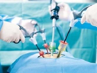 Service-Fertility-preserving Laparoscopy