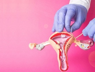 Service-Lap Tuboplasty