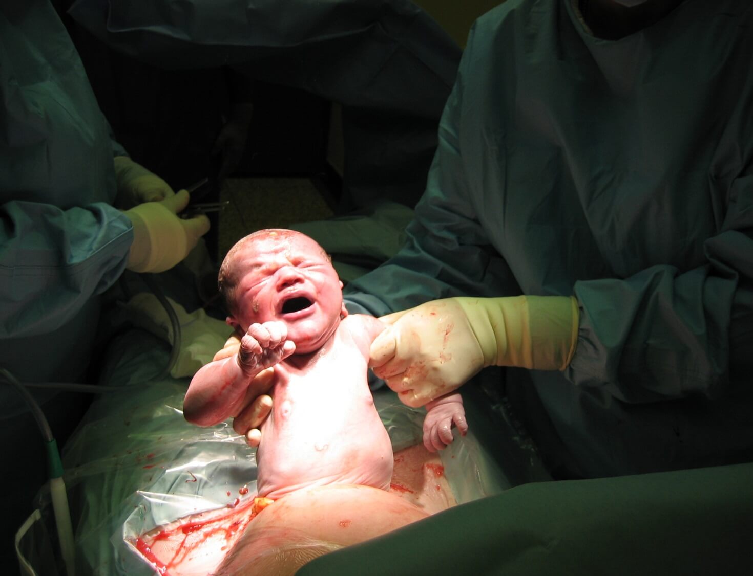 Service-Caesarean Section